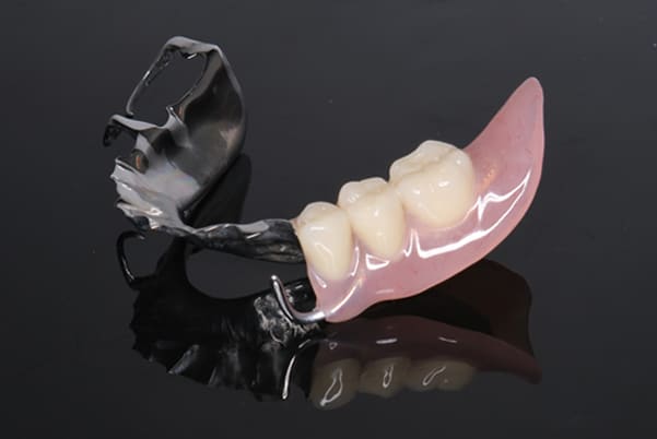 製作した部分入れ歯