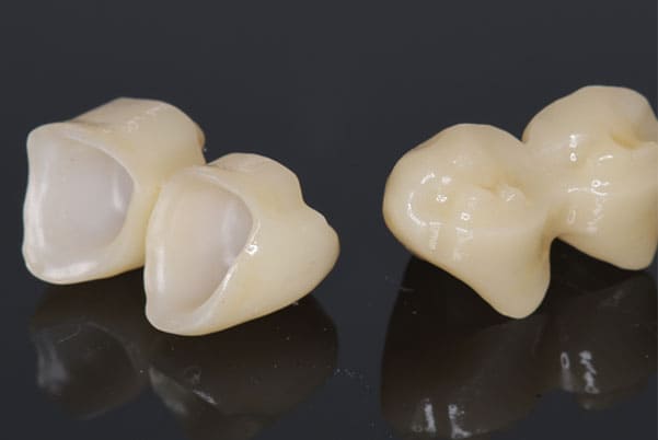 銀歯からセラミック歯に