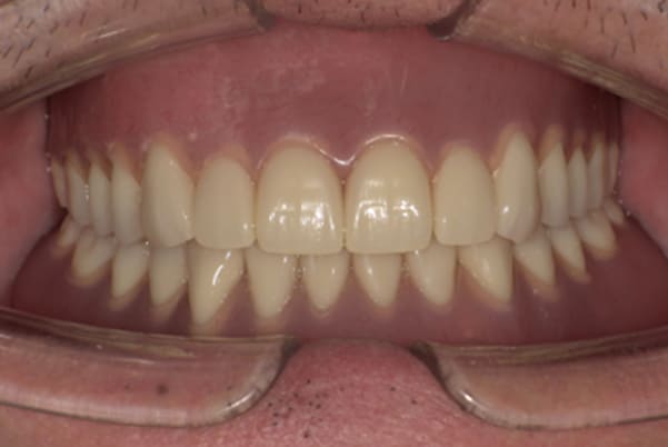 子供の結婚式で恥ずかしくないようにしたい治療後