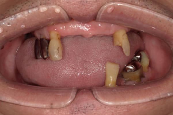 子供の結婚式で恥ずかしくないようにしたい治療前