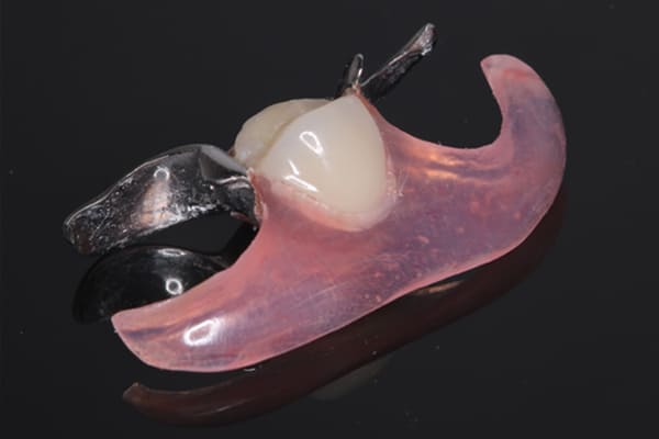 特殊なノンクラスプデンチャー