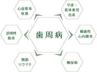 歯周病が全身の病気に及ぼす影響